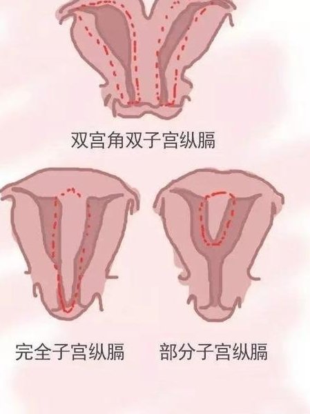 弱精症做试管成功率有多大？附完整流程及周期时长